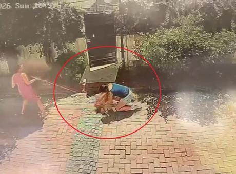 Sitede pitbull dehşeti! Küçük kızın gözleri önünde köpeğini ısırdı
