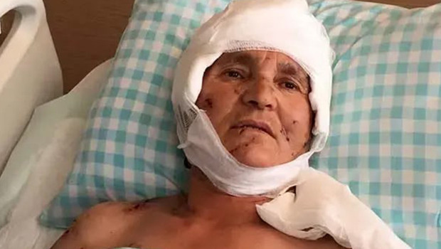 Yargıtay’dan köpek saldırısı kararı: Malul kalan kadına 637 bin lira tazminat