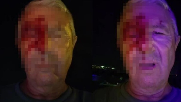 Haber yaparken saldırıya uğrayan muhabir yaralandı