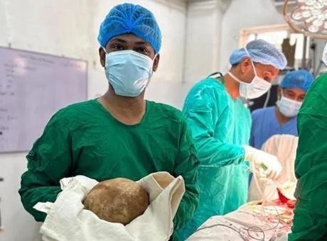 Sri Lanka’da akılalmaz ameliyat: Hastadan 3.1 kiloluk mesane taşı çıkarıldı