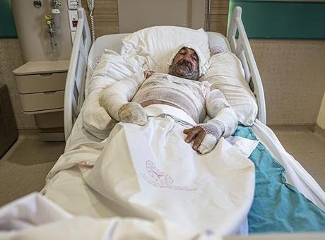 Kapalı balkona koydu, aileyi yaktı: Bir anda kendimi kaybettim