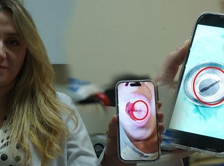 Doktor muayenede fark etti! 10 yaşındaki çocuğun boğazından canlı sülük çıktı