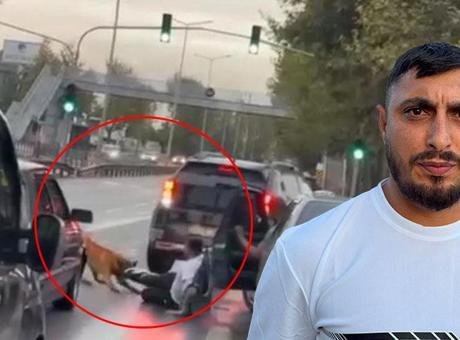 Yolda yürürken dehşeti yaşadı: Zincirini koparan köpek bacağından ısırıp yolda sürükledi