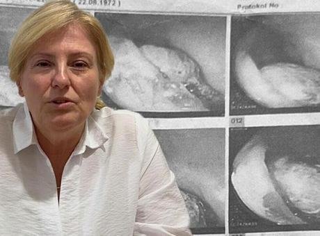 Gerçeği 4 yıl sonra öğrendi! Hayatının şokunu yaşadı: Bağırsağını delip, içine yerleşti