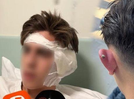 Piercing sonrası hastanelik olmuştu! Korkunç olay sonrası yeni gelişme